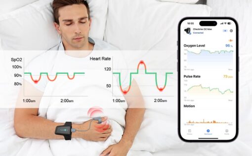 Wellue O2 Pulse Oximeter with Smart Reminder | Blood Oxygen Saturation Monitor for SpO2 and Heart Rate Tracking Continuously, Bluetooth Finger Ring with Free APP &PC Report - Image 6