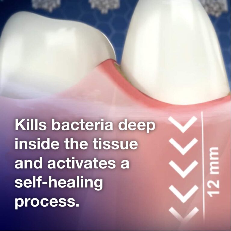 Emmi-dent Oral Waver Electric Toothbrush with 100% Ultrasound Technology, Gentle Vibration and Nano-Bubble Toothpaste. Ideal for Sensitive Teeth, Plaque Removal and More! (Half Year Supply Set) - Image 3