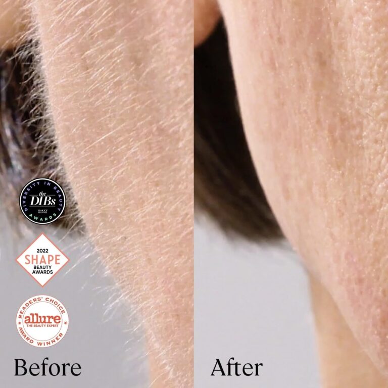 Michael Todd Beauty Sonicsmooth Pro+ Dermaplane Razor for Women Face + Eyebrow trimmer Dermaplaning System w/LED Light Peach Fuzz Remover -16 Dermaplaning Blades & 2 Microsmooth Microdermabrasion Tips - Image 5