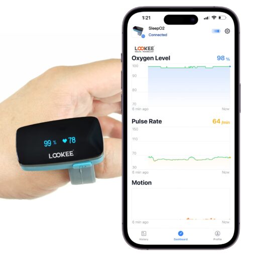 LOOKEE O2-Tracker Ring Continuous Pulse Oximeter - Wearable Oxygen Monitor with Vibration Reminder for Low O2 - Rechargeable Blood Oxygen Saturation SpO2 Meter - Free APP with Reports - Image 7