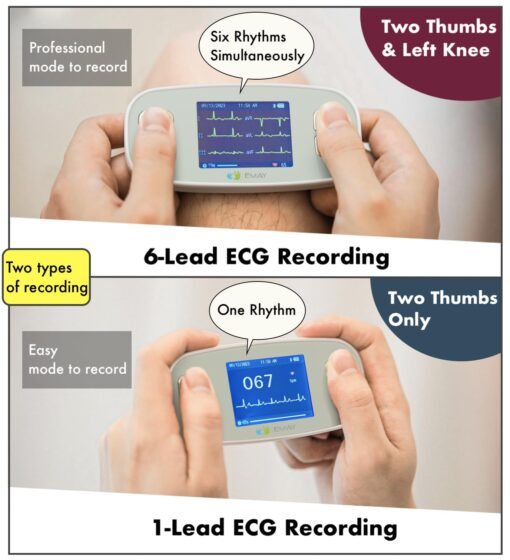 EMAY 6L Portable ECG Monitor | Record ECG and Heart Rate in 6 Channels | Compatible with Smartphone and PC | No Subscription Required - Image 6