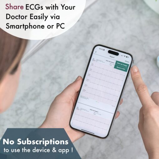 EMAY 6L Portable ECG Monitor | Record ECG and Heart Rate in 6 Channels | Compatible with Smartphone and PC | No Subscription Required - Image 5