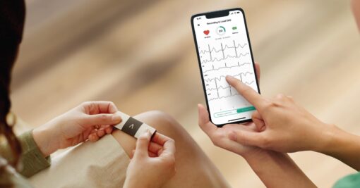KardiaMobile 6-Lead Personal EKG Monitor – Six Views of The Heart – Detects AFib and Irregular Arrhythmias – Instant Results in 30 Seconds – Works with Most Smartphones - FSA/HSA Eligible - Image 5