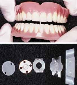 Coble Intra-Oral Denture Balancer