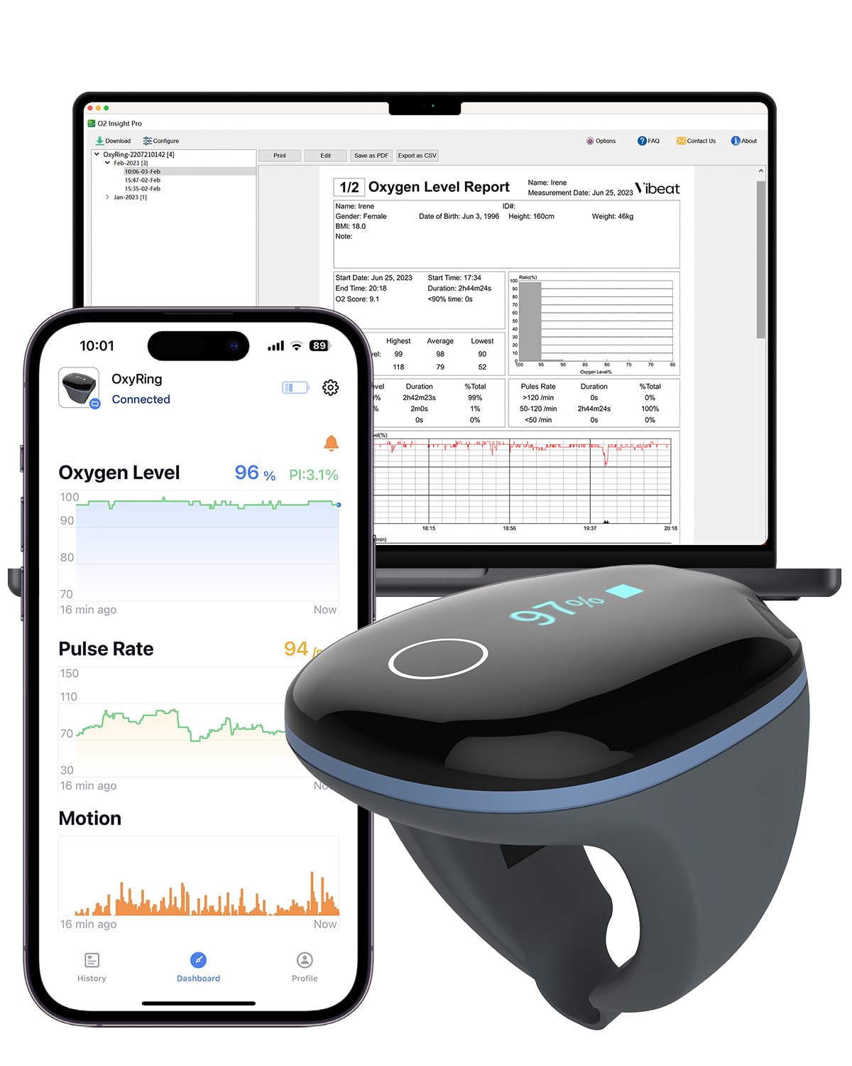 Vibeat OxyRing Continuous Oxygen Monitor - Bluetooth Pulse Oximeter with Real-time Reminder & Free PC Report, Wearable Finger Oxygen Meter for 16hrs Oxygen Level & Heart Rate Recording